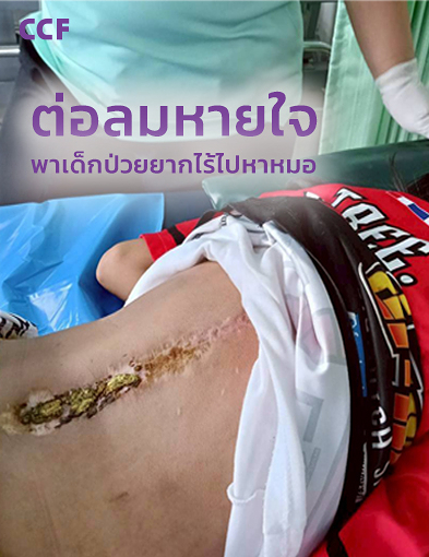 pun-boon-related-project